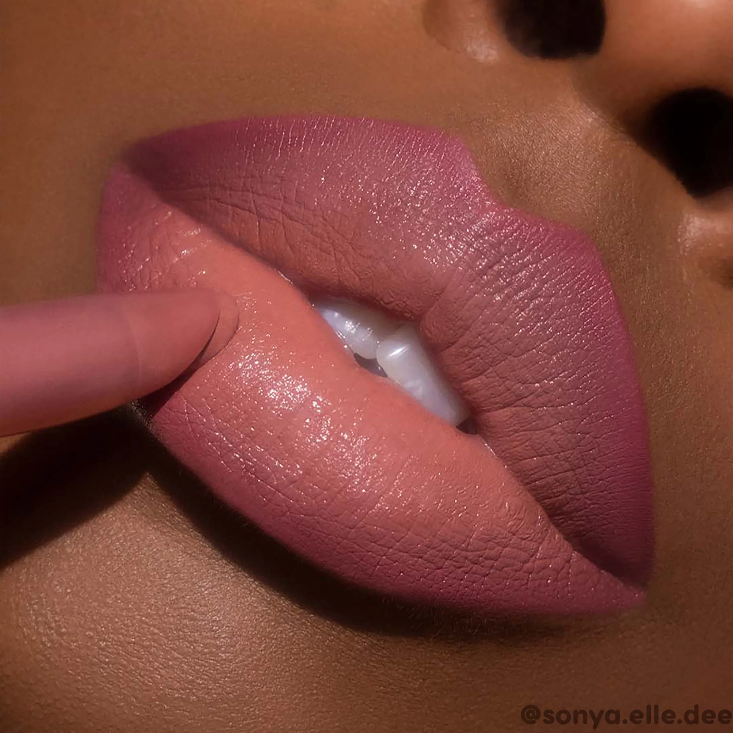 Kiss Me